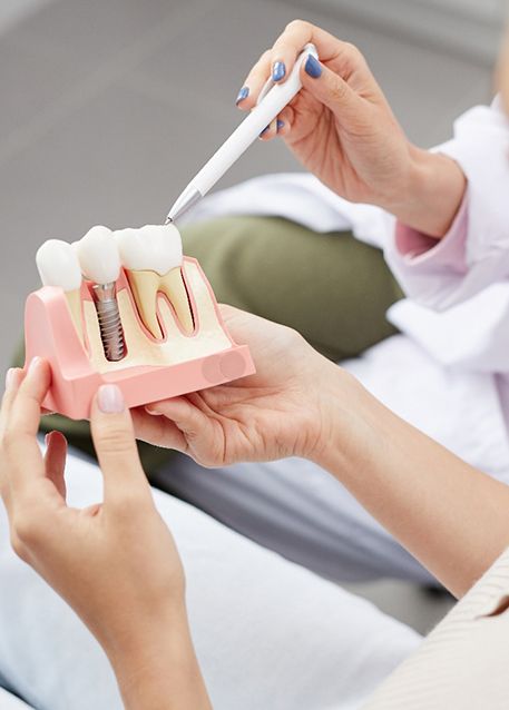 Dentist pointing to model implant held by patient