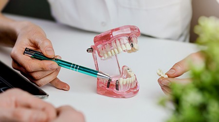 Dentist pointing to sample implant abutments with green pen