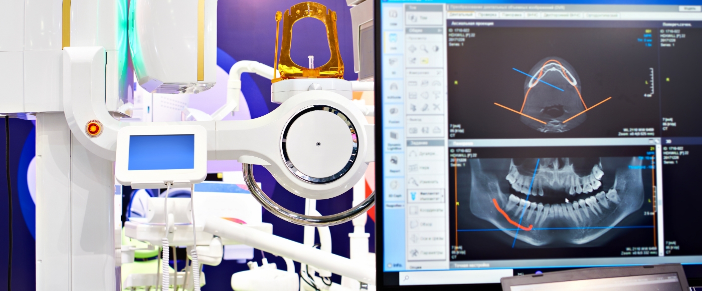 Computer screens showing models of the jaws and dental implant placement