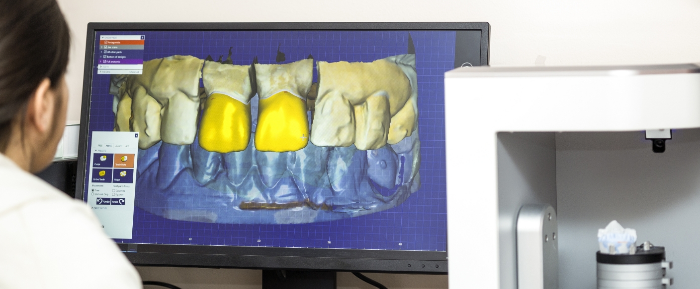 Dentist looking at a screen showing digital models for guided dental implant placement