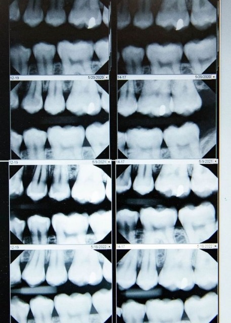 Dentist showing a tablet screen to a patient in the dental chair